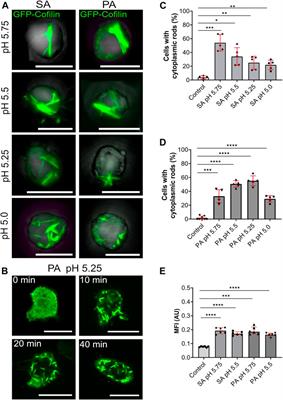 Formation of Cytoplasmic Actin-Cofilin Rods is Triggered by Metabolic Stress and Changes in Cellular pH